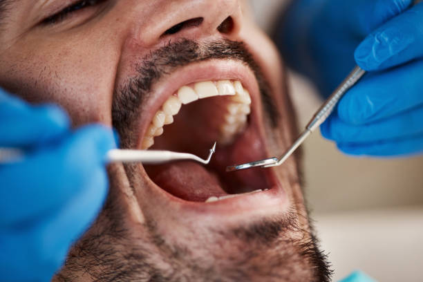 Best Urgent Tooth Repair  in First Mesa, AZ